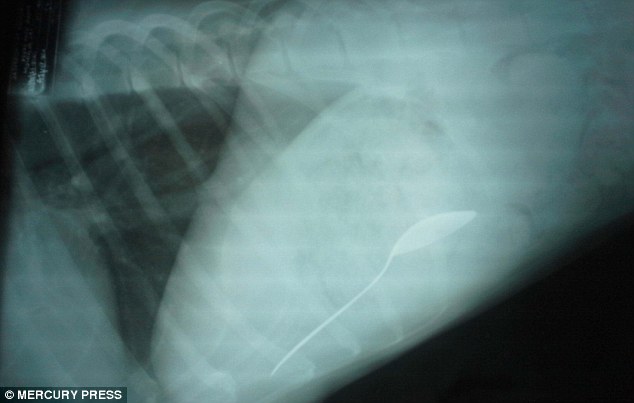 An x-ray clearly revealed that a spoon was lodged inside a mixed-breed dog taken to a vet surgery in Utah 