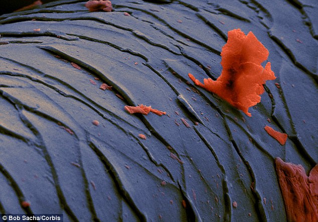 Dander is microscopic, and can be transported through the air where it’s able to enter the mucus membranes in the lungs, causing allergies for some people and animals. It's coloured red in this microscopic image