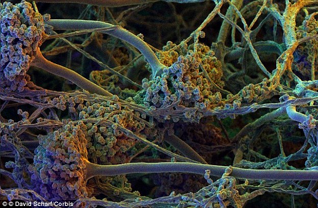 Doctors sent out a warning about Aspergillus fumigatus spores (pictured), after treating a rising number of patients who have inhaled them. These can cause lung infections and aggravate other health problems